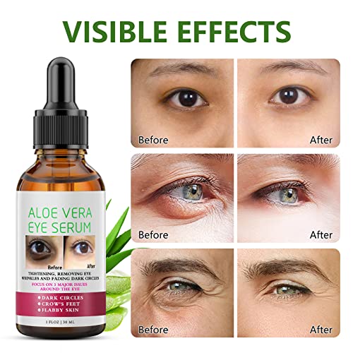 מוצרים לטיפול בעיניים בסרום עיניים, אלוורה מתחת למבהיר עיניים, סרום עיניים אנטי מזדקן למעגל כהה ונפיחות מעגל