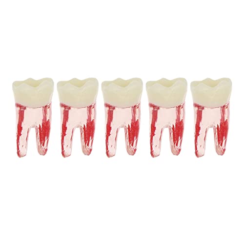 5 יחידות שורש שיניים שורש שיניים עיסת חלל שיניים דגם אנדודונטי תרגול RCT Topodont M8007 11