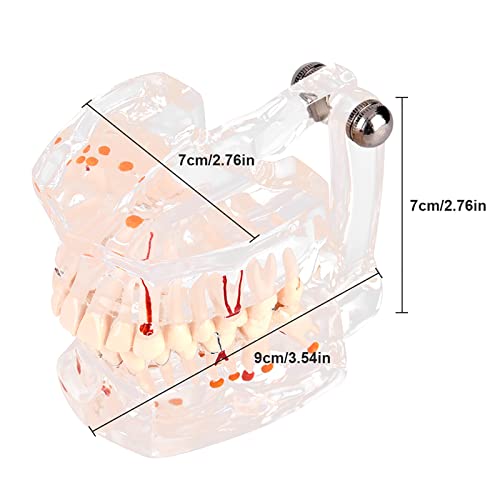 שיניים דגם שיניים דגם פה דגם שקוף חניכיים שן חינוך דגם מחלה עם עצב עבור שיניים הוראת מחקר