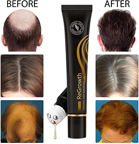 2 יחידות לצמיחה מחודשת אורגני שיער סרום רולר סט, שיער טיפול אנטי הפשטת נוזל, לשלושה רול-על לעיסוי שיער צמיחת